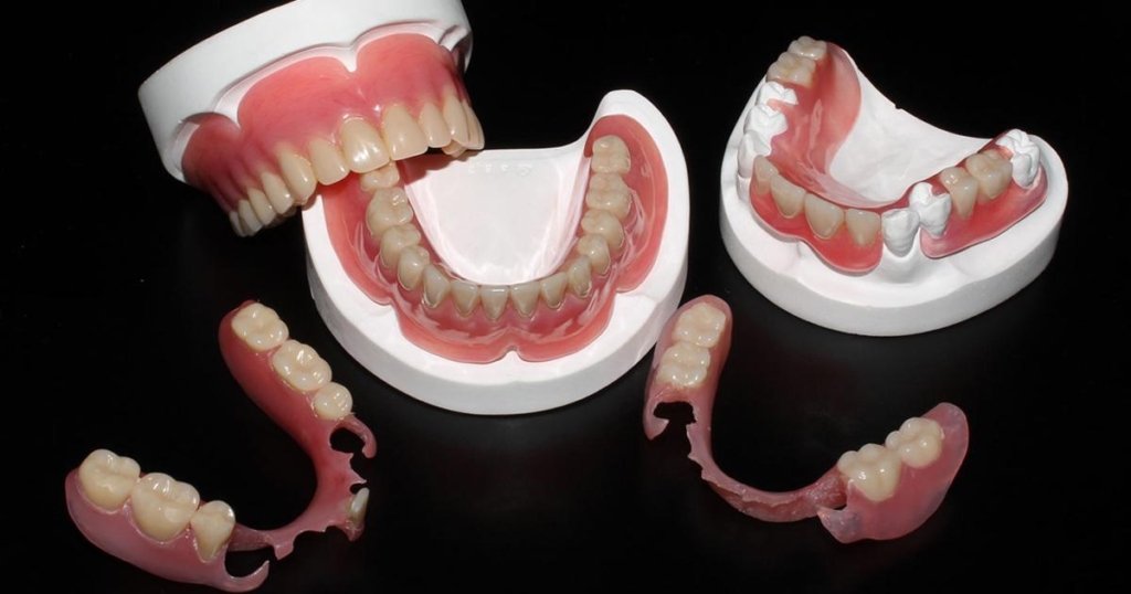 Punte dentara | DentExpert ©